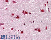 Anti-JUN / c-Jun Antibody (aa210-259) IHC-plus LS-B7572