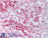Anti-MARCKS Antibody (aa136-185) IHC-plus LS-B7573