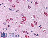 Anti-EGLN1 / PHD2 Antibody (aa1-50) IHC-plus LS-B166