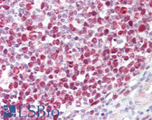 Anti-RB1 / Retinoblastoma / RB Antibody (aa781-830) IHC-plus LS-B7581