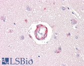 Anti-RPS6KB1 / P70S6K / S6K Antibody (aa337-386) IHC-plus LS-B7583