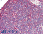 Anti-ZAP70 Antibody (aa460-509) IHC-plus LS-B7584