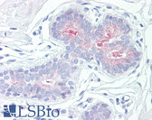 Anti-RPS6KB1 / P70S6K / S6K Antibody (aa393-442) IHC-plus LS-B7588