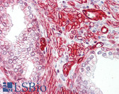 Anti-GAB2 Antibody (aa125-174) IHC-plus LS-B7589