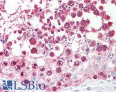 Anti-CSE1L Antibody (aa1-50) IHC-plus LS-B7593