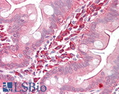 Anti-EZR / Ezrin Antibody (aa511-560) IHC-plus LS-B7599