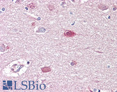 Anti-GAD1 / GAD67 Antibody (aa471-520) IHC-plus LS-B7600
