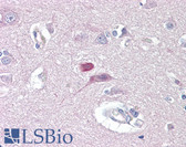 Anti-GRM4 / MGLUR4 Antibody (aa851-900) IHC-plus LS-B7601