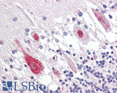 Anti-GUCY1B3 Antibody (aa10-59) IHC-plus LS-B7603