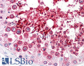 Anti-HDAC6 Antibody (aa1166-1215) IHC-plus LS-B7604