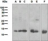 Anti-LGALS1 / Galectin 1 Antibody (Internal, clone EPR3205) IHC-plus LS-B7608