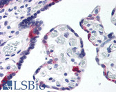Anti-APOER2 / LRP8 Antibody (aa863-963) IHC-plus LS-B169