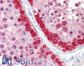 Anti-MAGEA1 / MAGE 1 Antibody (aa260-309) IHC-plus LS-B7611