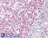 Anti-EP300 / p300 Antibody (aa1-50) IHC-plus LS-B7613