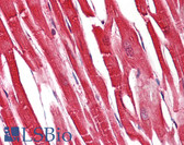 Anti-S100A1 / S100-A1 Antibody (aa10-59) IHC-plus LS-B7617