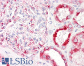 Anti-PAK1 Antibody (aa178-227) IHC-plus LS-B7619