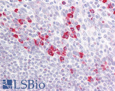 Anti-PAK1 + PAK2 + PAK3 Antibody (aa391-440) IHC-plus LS-B7620