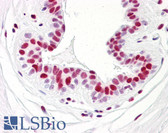 Anti-PR / Progesterone Receptor Antibody (aa371-420) IHC-plus LS-B7621
