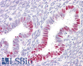 Anti-SP1 Antibody (aa421-470) IHC-plus LS-B7624