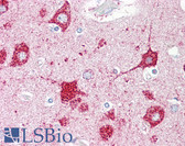 Anti-SYP / Synaptophysin Antibody (aa101-150) IHC-plus LS-B7626