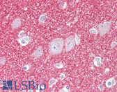 Anti-SNCB / Beta-Synuclein Antibody (aa85-134) IHC-plus LS-B7627