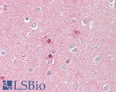 Anti-UBR5 Antibody (aa1-50) IHC-plus LS-B7629