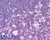 Anti-MLXIPL / CHREBP Antibody (aa800-852) IHC-plus LS-B171