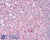 Anti-PRKCD / PKC-Delta Antibody (aa471-520) IHC-plus LS-B7634