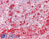 Anti-PLD1 / Phospholipase D1 Antibody (aa527-576) IHC-plus LS-B7636