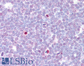 Anti-CAMK4 Antibody (aa166-215) IHC-plus LS-B7641