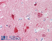 Anti-CRYAB / Alpha B Crystallin Antibody (aa10-59) IHC-plus LS-B7643