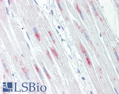 Anti-CRYAB / Alpha B Crystallin Antibody (aa21-70) IHC-plus LS-B7644