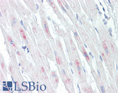 Anti-CRYAB / Alpha B Crystallin Antibody (aa31-80) IHC-plus LS-B7645
