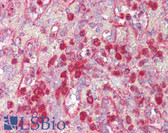 Anti-PIAS3 Antibody (aa10-59) IHC-plus LS-B7646