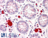 Anti-DAPK2 / DAP Kinase 2 Antibody (aa284-333) IHC-plus LS-B7647