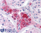 Anti-SCP1 / SYCP1 Antibody (C-Terminus) IHC-plus LS-B173