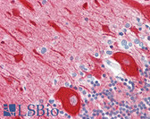 Anti-TUBB / Beta Tubulin Antibody (aa401-450) IHC-plus LS-B7652
