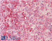 Anti-TUBG1 / Tubulin Gamma 1 Antibody (aa386-435) IHC-plus LS-B7653