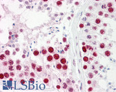 Anti-SAE2 / UBA2 Antibody (aa591-640) IHC-plus LS-B7654