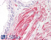 Anti-IRAK1 / IRAK Antibody (aa175-224) IHC-plus LS-B7660