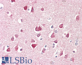 Anti-KCNJ11 / Kir6.2 Antibody (aa190-239) IHC-plus LS-B7661