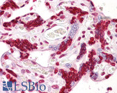 Anti-IPP2 / PPP1R2 Antibody (aa86-135) IHC-plus LS-B7663