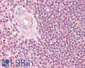 Anti-RAD52 Antibody (aa70-119) IHC-plus LS-B7664
