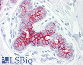 Anti-HEP / EPHB6 Antibody (aa861-910) IHC-plus LS-B7665