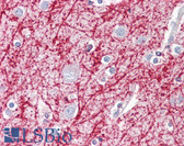 Anti-TNFSF13 / APRIL Antibody (aa151-200) IHC-plus LS-B7666