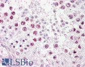 Anti-TOP2A / Topoisomerase II Alpha Antibody (aa1-50) IHC-plus LS-B7670
