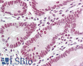 Anti-HNRNPL / hnRNP L Antibody (aa61-110) IHC-plus LS-B7671