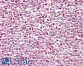 Anti-HCF1 / HCFC1 Antibody (aa131-180) IHC-plus LS-B7675
