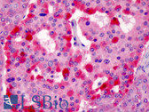 Anti-STRADB / ALS2CR2 Antibody (Internal) IHC-plus LS-B178