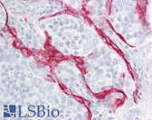 Anti-PARP3 Antibody (aa10-59) IHC-plus LS-B7682